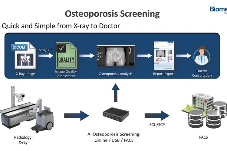 Mekanisme metode OsteoCloud dalam melakukan deteksi Osteoporosis