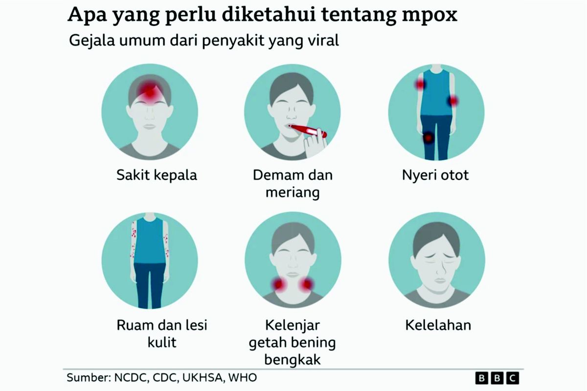 Gejala Mpox yang diketahui.