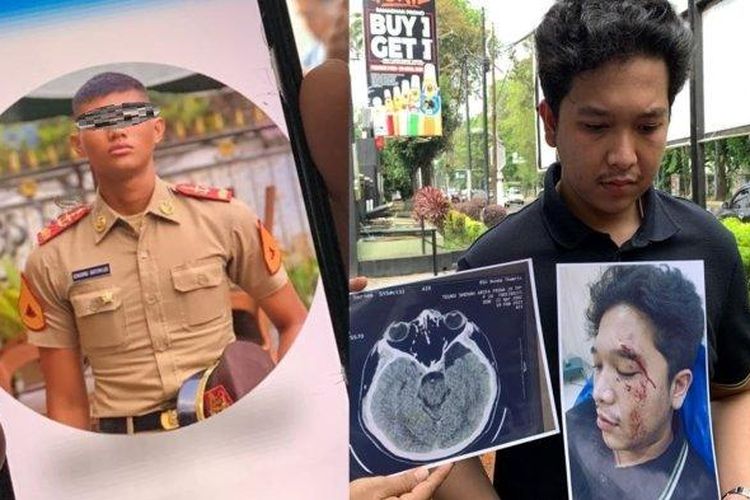 Taruna Akmil diduga menganiaya mahasiswa FK UISU bernama Teuku Shehan Arifa Pasha.

