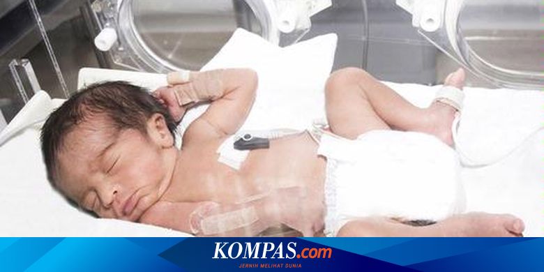 Perawatan Bayi Dengan Masalah Kuning Setelah Lahir Halaman All Kompas Com