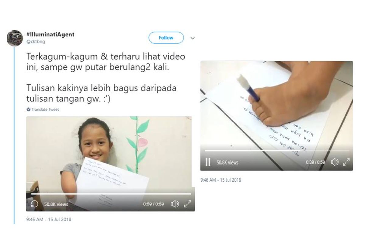 Novia Kusuma Anggraini (8), gadis cilik yang mengungkapkan kebahagiaannya setelah mendapatkan kaki palsu. Ia juga berharap, suatu saat memiliki tangan bionik.