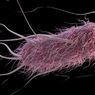 Air Sungai di Kota Yogyakarta Tercemar E-coli, Ini Dampaknya bagi Warga