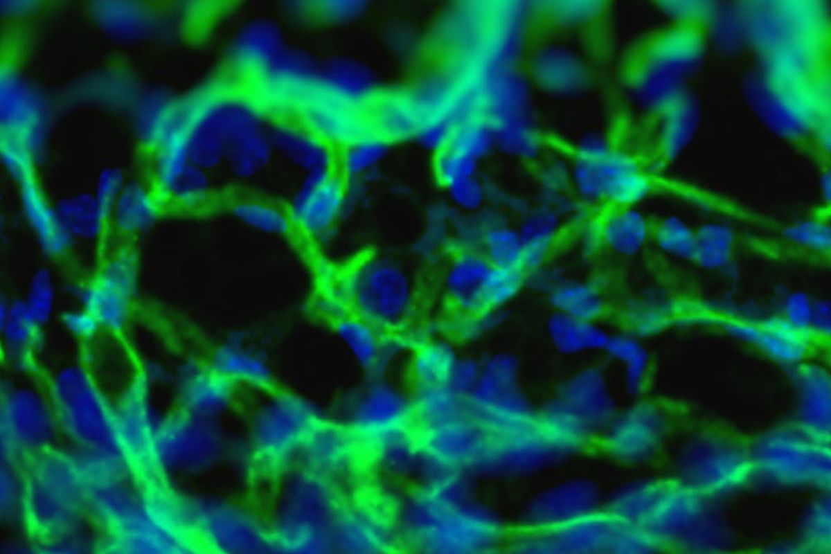 Gambar mikroskopis fluoresens dari pembuluh darah yang baru terbentuk setelah injeksi hidrogel berbahan dasar rumpur laut pada otot. Warna hijau menunjukkan pembuluh darah sedangkan warna biru menunjukkan inti sel.