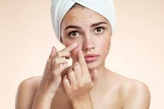 4 Skincare Penyebab Jerawat Semakin Parah