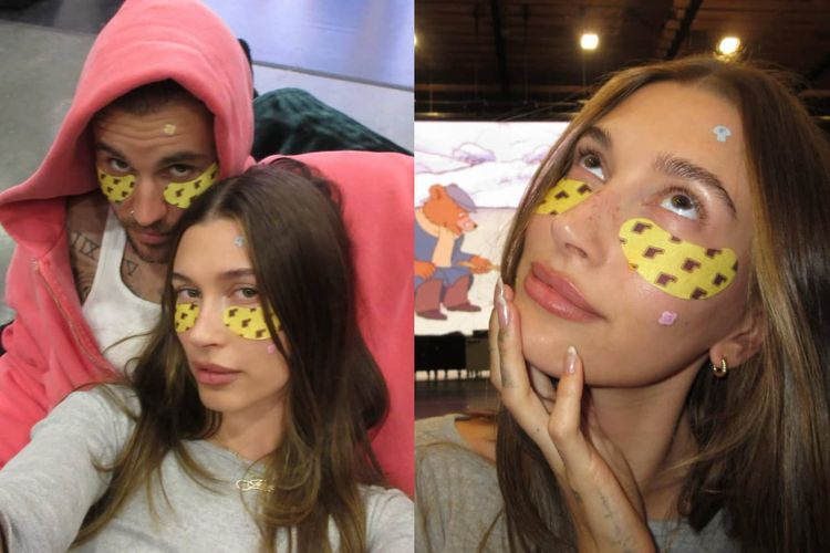 Pakai Under-eye Patch ala Hailey Bieber, Ampuh Mengatasi Masalah Bawah Mata atau Cuma Tren?