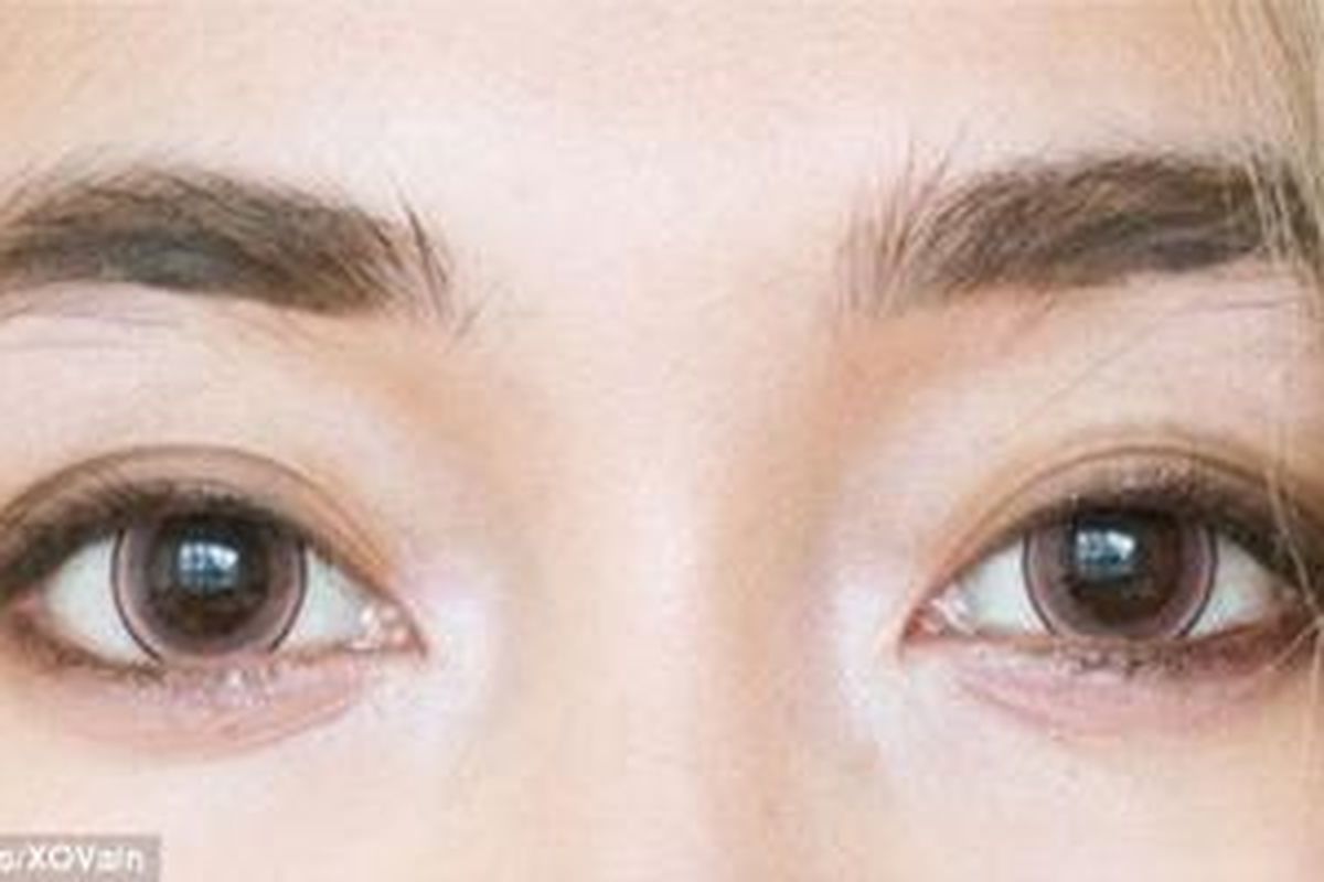 Pada tahun 2010, Karen Riley, juru bicara US Food and Drug Administration (F.D.A), memberitahu New York Times bahwa jika membeli tanpa resep dari ahli mata, circle lenses beresiko membuat cidera pada mata hingga mengalami kebutaan. 