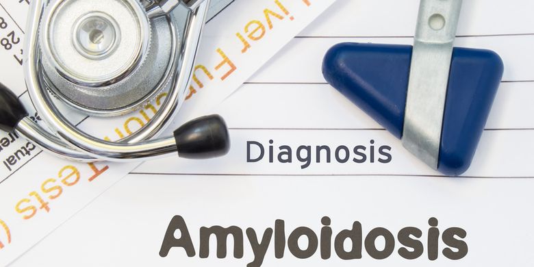 Penyakit Amiloidosis - Gejala, Penyebab, Pengobatan - Vimarsana News