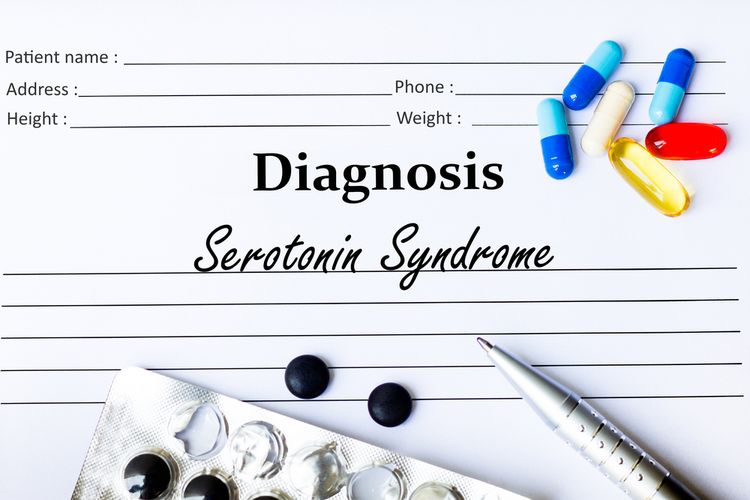 Ilustrasi sindrom serotonin