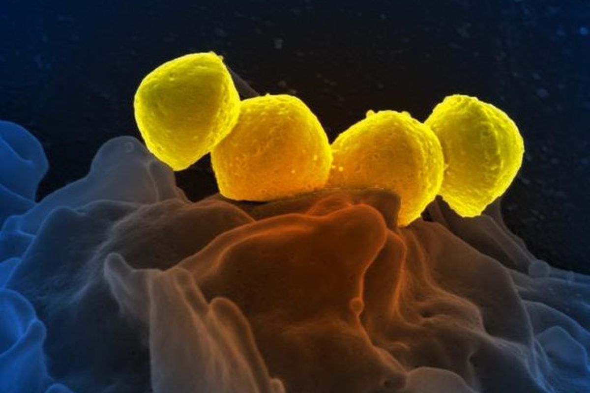 Ilustrasi bateri Streptococcus pyogenes. Streptococcal toxic shock syndrome adalah penyakit akibat infeksi bakteri Streptococcus pyogenes yang disertai syok mendadak dan kegagalan organ.