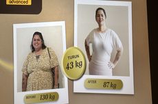 Pilih Bedah Bariatrik, Jelita Ramlan Sukses Turun BB 43 Kg