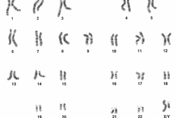 Kariotipe laki-laki manusia, menunjukkan 23 pasang autosom manusia termasuk heterosom XY.