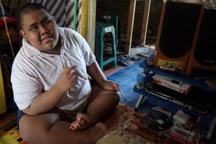 Jody Syawaldi (16) memiliki berat 115 kilogram dan hanya beraktifitas di dalam rumah