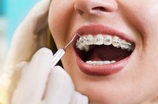 Apakah Pemasangan Behel Gigi Bisa Ditanggung BPJS Kesehatan?