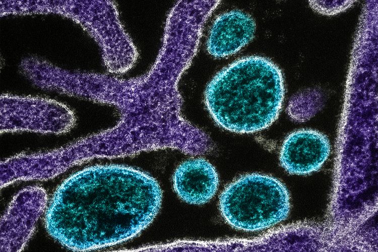 Penampakan partikel virus Nipah (biru) yang berada di pinggiran sel VERO yang terinfeksi (ungu). Gambar diambil dan ditingkatkan warnanya di NIAID Integrated Research Facility di Fort Detrick, Maryland. Penularan virus Nipah dari hewan ke manusia, dan 40 persen penularan dari manusia ke manusia.