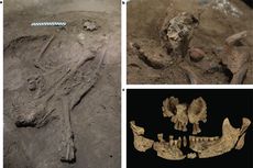 Temukan Kerangka 31.000 Tahun dengan Bukti Awal Operasi, Arkeolog Indonesia dan Australia Tulis Ulang Sejarah Manusia