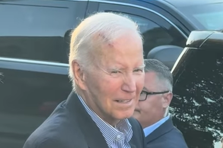 Joe Biden Muncul dengan Luka Kepala, Ternyata Usai Jalani Operasi Kanker Kulit