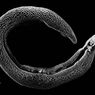 Schistosomiasis