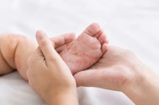 Arus Wisata Padat Sejak Pagi, 2.900 Kendaraan Datangi Puncak Bogor