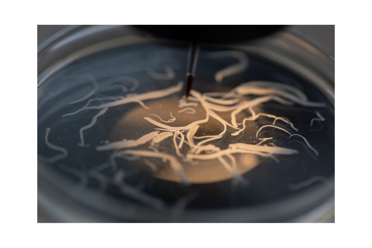 ilustrasi cacing ascariasis atau cacing gelang yang terdapat di perut anak di Jember.