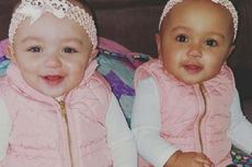 Meski Langka, Bayi Kembar Beda Ras Bisa Terjadi