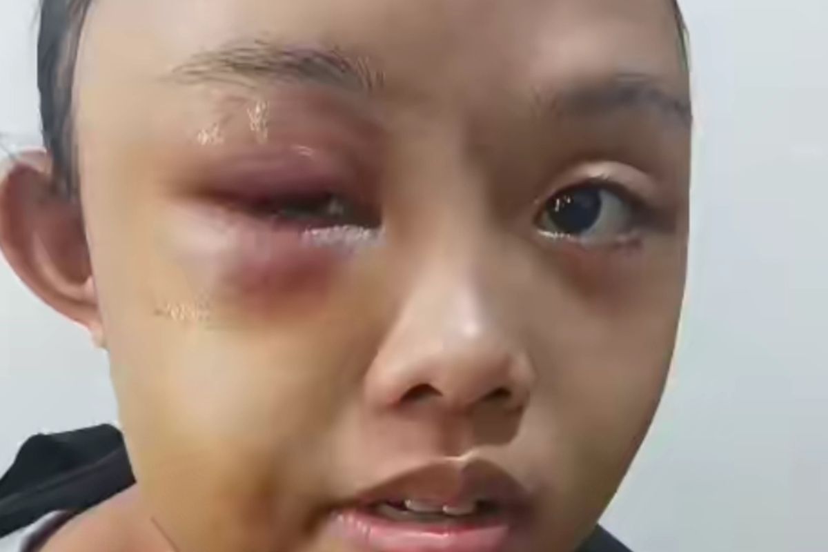 Tangkapan layar video anak yatim piatu babak belur dianiaya tantenya, di Desa Torai Bangun, Kecamatan Tambang, Kabupaten Kampar, Riau, Minggu (25/5/2025).
