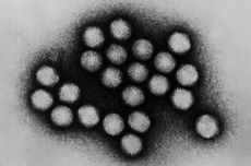 Penyebab Hepatitis Akut Misterius Anak Diduga Disebabkan Adenovirus, Virus Apa Itu?