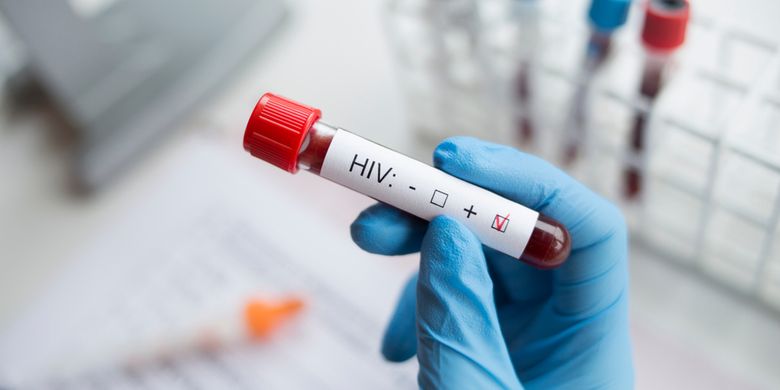 Ilustrasi HIV/AIDS, gejala awal HIV, ciri-ciri HIV, gejala HIV, gejala klinis HIV menurut WHO, tahap HIV.