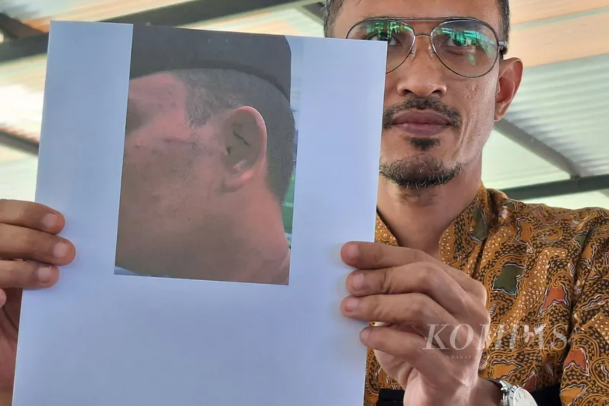 Penasihat hukum, Jumat (30/5/2025), memperlihatkan foto luka yang dialami KDR (23), korban dugaan penganiayaan yang dilakukan 13 santri di Pondok Pesantren Ora Aji, Sleman, DI Yogyakarta.