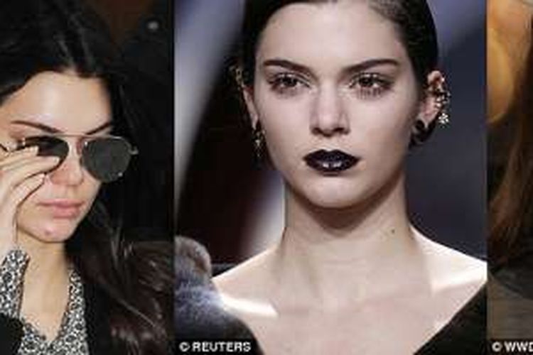 Jerawat Kendall Jenner yang besar, lalu menghilang di peragaan busana Dior. 