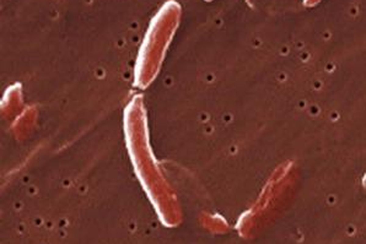 Bakteri Vibrio penyebab kolera dilihat dengan Scanning electron micrograph (SEM). 