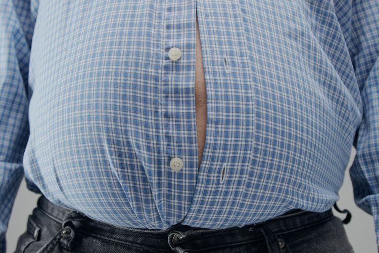 Ilustrasi obesitas, salah satu ciri sindrom metabolik
