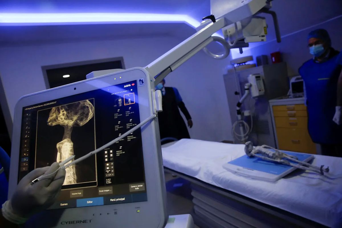 Pengujian jasad alien yang dilakukan di Noor Clinic, Meksiko, Senin (18/9/2023).
