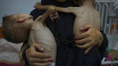 10.000 Lebih Anak Kota Gaza Derita Gizi Buruk Akut di Tengah Perang