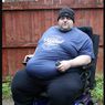 Obesitas, Mantan Binaragawan Ini Terancam Mati