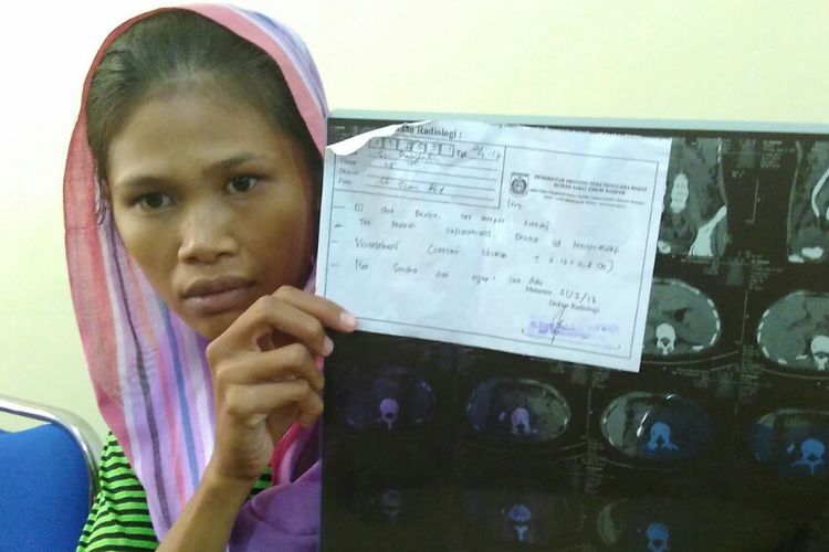Sri Rabitah (25) mantan TKI asal Lombok, Nusa Tenggara Barat memperlihatkan hasil Rontgen ginjalnya.