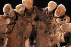 Gigi Keropos, Masalah Klasik Manusia sejak Zaman Batu