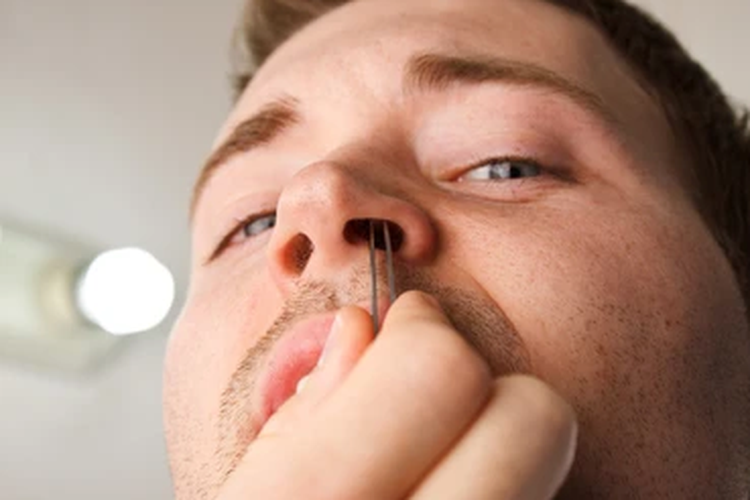 Bulu hidung bermanfaat untuk menyaring kotoran dari udara yang dihirup. 