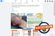 INFOGRAFIK: Tidak Benar Ada Pasien Mpox di RS Siloam Ambon, Cek Faktanya