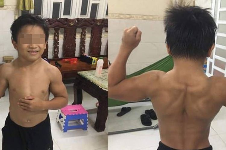 Sebuah foto kolase tak bertanggal menunjukkan bocah berusia 10 tahun, Nguyen Hoang Nam, menunjukkan otot-ototnya.