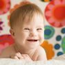 Down Syndrome, Kondisi Tubuh Kelebihan Kromosom