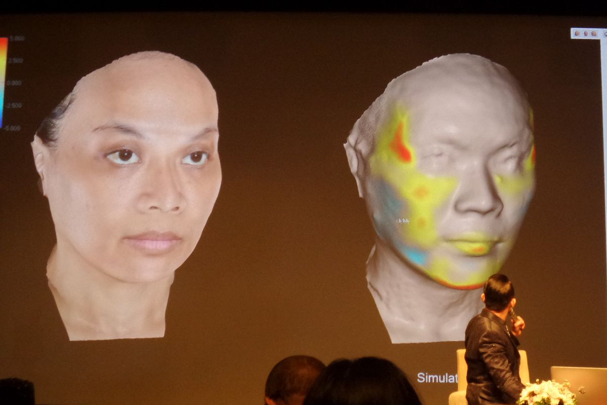 Contoh analisa wajah menggunakan teknologi 3 dimensi yang bisa mengetahui area wajah mana yang membutuhkan koreksi.
