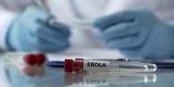 WHO Deklarasikan Keadaan Darurat Kesehatan Global untuk Varian Ebola Langka