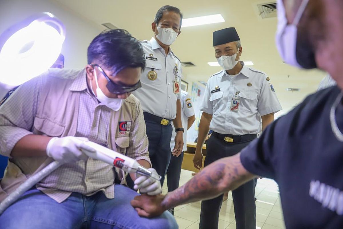 Wali Kota Jakarta Utara Ali Maulana Hakim menyaksikan salah satu warga yang mengikuti roadshow hapus tato di Kantor Wali Kota Jakarta Utara, Rabu (20/4/2022).