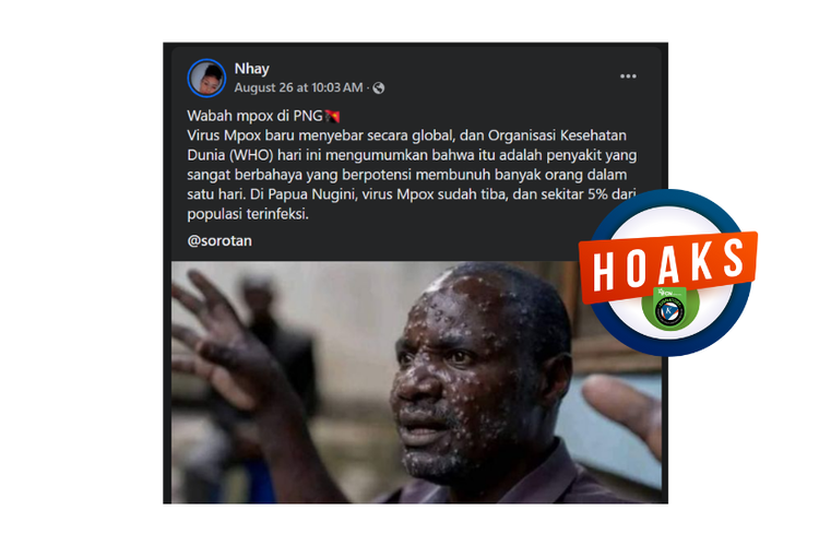 Hoaks, wabah Mpox menyebar di Papua Nugini