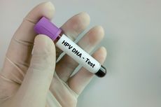 Percepat Deteksi Dini Kanker Serviks, Kemenkes Gunakan Tes HPV DNA