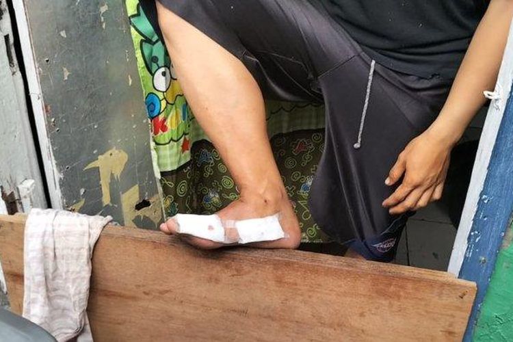 Rahmat (19), penghuni kontrakan yang menemukan sekaligus menjadi korban ledakan granat kejut di Semper Barat, Cilincing, Jakarta Utara, Rabu (28/9/2022). (TribunJakarta.com/Gerald Leonardo Agustino)