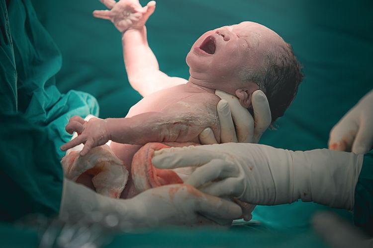 Ilustrasi bayi pada proses persalinan. 