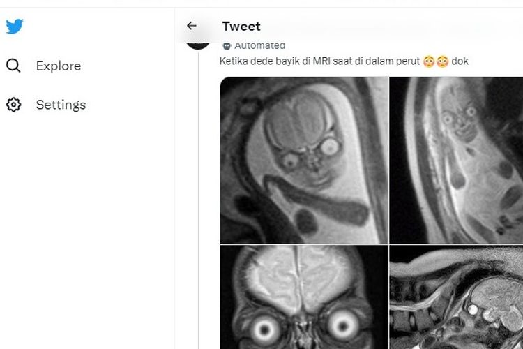Foto janin hasil MRI yang viral di media sosial.