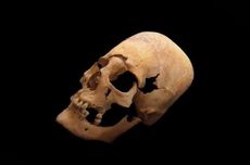 Misteri Tengkorak Berbentuk Kerucut dari Iran, Siapa Pemiliknya?