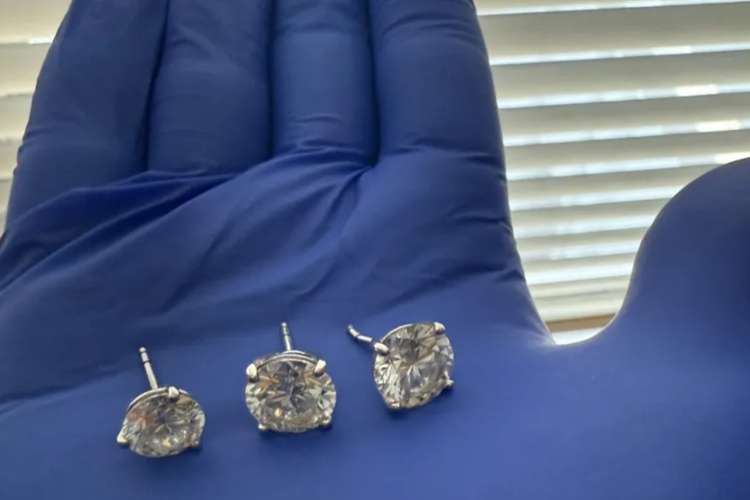 Pencuri Ini Telan Anting Berlian Rp 13,7 Miliar Saat Ditangkap Polisi, Begini Akhirnya